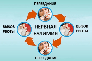 Лечение булимии в Мозыре